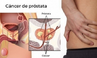 Imagen Ilustrativa. Foto.Internet