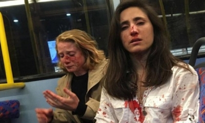 La joven uruguayo denunció la agresión en las RRSS/Foto. Facebook