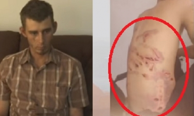 El joven tiene 20 días de impedimento/Foto. Captura de pantalla