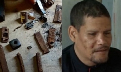 Leosbani Pino López, le extrajeron 32 objetos metálicos de su estómago. Foto: Ojo.pe