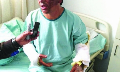 Luis Alberto Barja se recupera en el hospital Jaime Mendoza