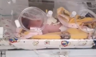 La bebé será operada en Santa Cruz/Foto. Captura de pantalla 