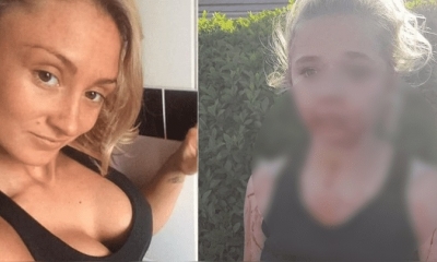 Según la madre de la víctima, su hija teme salir a la calle y tiene secuelas de los golpes.