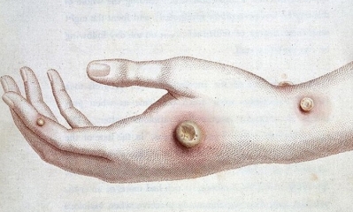 Imagen Ilustrativa. Foto: RT 
