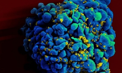 Escaneo electromicrográfico de una célula T infectada con VIH (NIAID)
