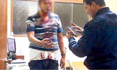 Una persona en estado de ebriedad causó una herida cortante a otra, en una pelea campal 
