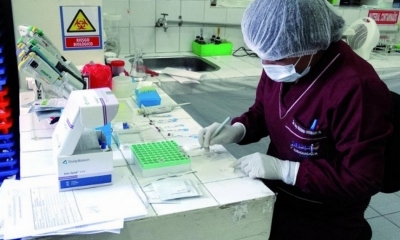 En el SEDES toman muestras rápidas para confirmar o descartar casos.