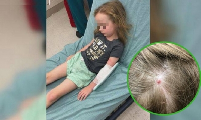 La pequeña de 5 años había perdido repentinamente la capacidad de caminar y hasta de hablar. Foto: Ojo.pe