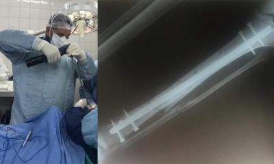 Su recuperación durará 6 meses/Foto. Kandire 