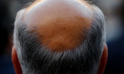 Imagen Ilustrativa. Foto: RT 