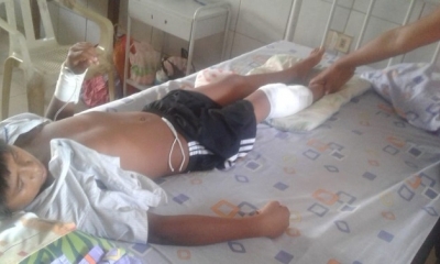El menor se recupera favorablemente en el Hospital Municipal de Guarayos. Foto: EL DEBER