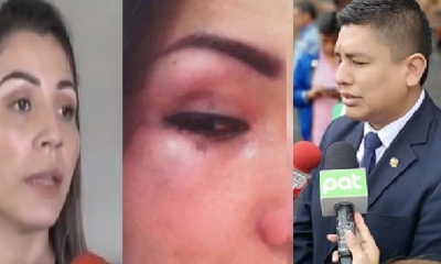 La mujer asegura que la golpeó por celos/Foto. Kandire