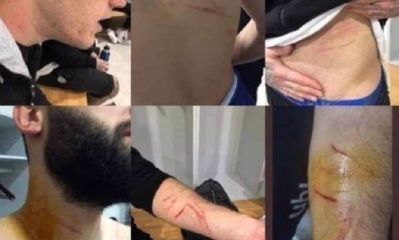 Tras las presuntas agresiones de ese deportista el encuentro se reanudó y terminó 1-1/Foto. RRSS