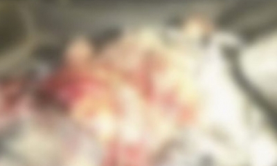 Una dinamita le explotó a la víctima/Foto. RRSS
