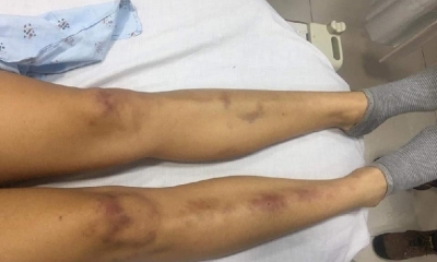 Así llegó la joven a la clínica/Foto. RRSS