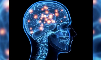 Cerebro. | Foto ilustrativa | Web