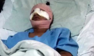 Por seis bolivianos le desfiguraron el rostro/Foto. RRSS
