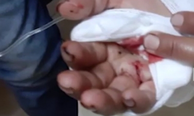 La víctima se recupera en el hospital/Foto. Kandire