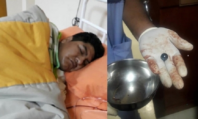 Los cocaleros heridos son atendidos en diferentes hospitales/Foto. RE