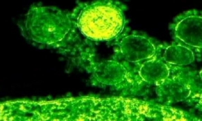 Alemania, que se ve fuertemente golpeada por la epidemia del nuevo coronavirus con 36.508 casos declarados actualmente