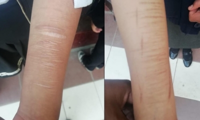 Los padres desconocían las heridas de sus hijos/Foto. Kandire