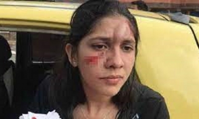 Mujer agredida con botella.