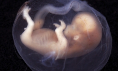 Nuevos modelos de embriones ayudarían a la investigación de abortos espontáneos y malformaciones