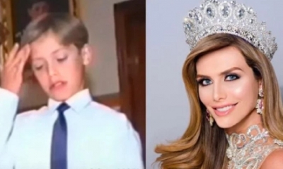 Angela Ponce un antes y un después/Foto. RRSS