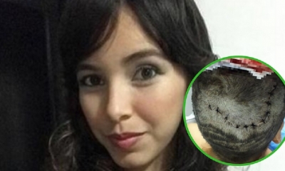 Así quedó la cabeza de la víctima/Foto. RRSS