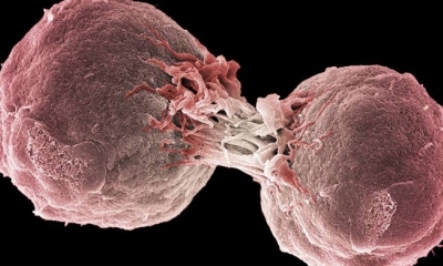 Científicos aseguran que esta sería la solución para el cáncer.