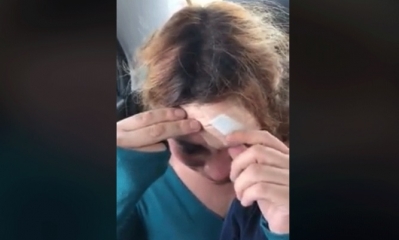 La mujer golpeada muestra su herida. Foto: Captura de video