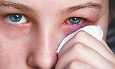 Brote de conjuntivitis en Trinidad