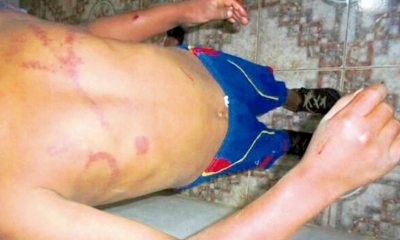 El menor confesó haber tomado el dinero, entonces su papá se enojó a tal extremo de agarrar un cinturón y darle de azotes.