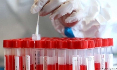 Científicos chinos presentan nuevo test de covid 
