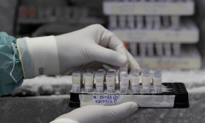 Muestras en laboratorio.