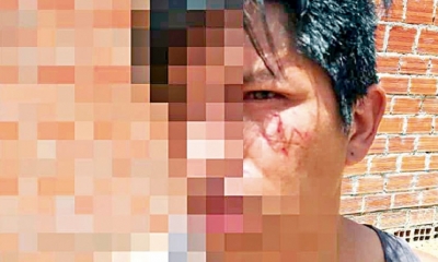 La pareja tiene tres hijos y las agresiones son frecuentes en el hogar.