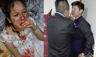 Así dejó a su esposa el agresor el día de su boda/Foto. Kandire