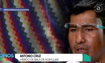 Antonio Cruz, víctima de un impacto de bala