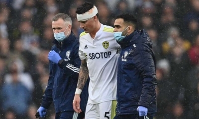 Robin Koch, Leeds United, se lesionó el cráneo el domingo.