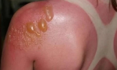 Imagen Referencial/Foto. RRSS