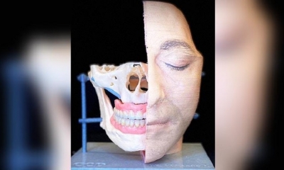 Avances. Modelo estereolitográfico 3D multifunción posquirúrgica. Impresos desde la piel, prótesis, huesos e implantes dentales convencionales 