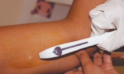 Más de 11 mil mujeres solicitaron los implantes subdérmicos entre enero y mayo, en Bolivia. Foto: EL DEBER