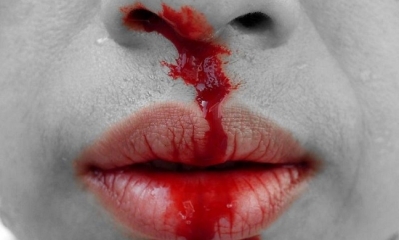 Imagen Ilustrativa. Foto: Internet