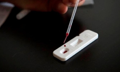 Los investigadores esperan que el organismo humano tenga una respuesta inmune contra estos segmentos que proteja contra el virus 