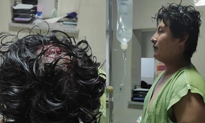 El reporte médico realizado en el Hospital Rubén Zelaya, establece que la víctima presenta cinco heridas punzocortantes en la cabeza