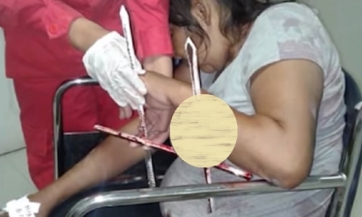 La mujer quedó media hora entre los fierros/Foto. Captura de pantalla 