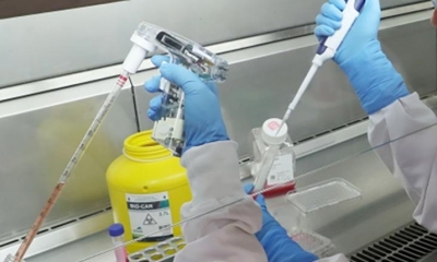Pruebas de laboratorio para coronavirus. | EFE