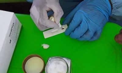 Brigadas alistan insumos para la toma de muestras. 