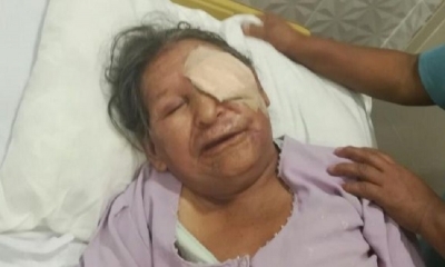 La mujer está postrada en cama luego de la agresión
