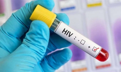 Cabotegravir, Lucha global contra el VIH.